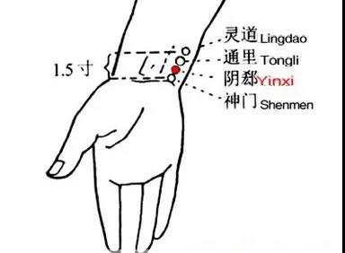 睡觉爱出汗，艾灸这几个穴位